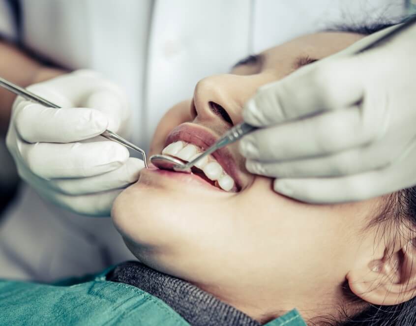 Behandling af slidte tænder hos tandlæge