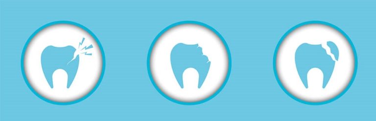 Knækkede tænder kræver professionel tandbehandling