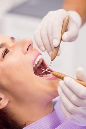 Tandrens og fjernelse af tandsten