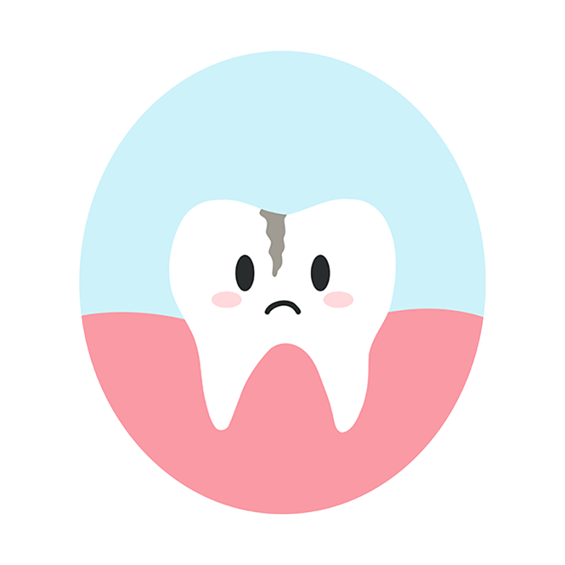 Få behandlet revner i tænder her hos tandlæge